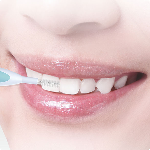 Teicneolaíocht Buletedan