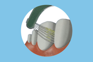 Teicneolaíocht Buletedan